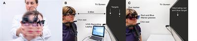 Videooculography “HINTS” in Acute Vestibular Syndrome: A Prospective Study